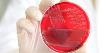 Identifican un mecanismo molecular que desactiva la inflamación en el cuerpo humano