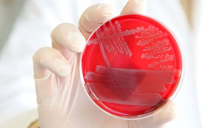 Identifican un mecanismo molecular que desactiva la inflamación en el cuerpo humano